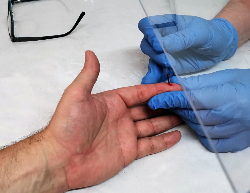 Quantitativer Covid 19 ANTIKOeRPER Schnelltest Apotheke Molln 1